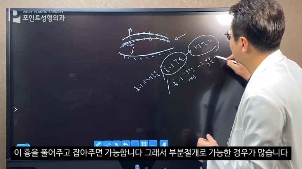 원장이 화면에 눈꺼풀 선과 메모를 적어 가며 설명하는 모습
